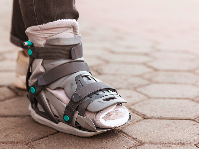 Moderne orthopädische Fußorthesen und Schienen für individuelle Mobilitätsbedürfnisse, gefertigt in Frankfurt für optimale Funktionalität.
